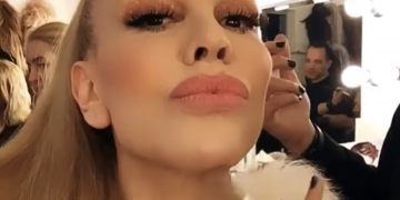 Луна се подмлади! Сложи скули и опъна бръчките